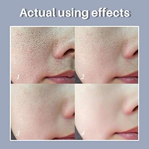 LANBENA Original Pore Solution Serum
